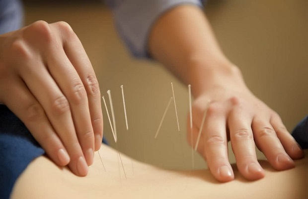Châm cứu đòi hỏi kỹ năng nhiều hơn massage thông thường Châm cứu